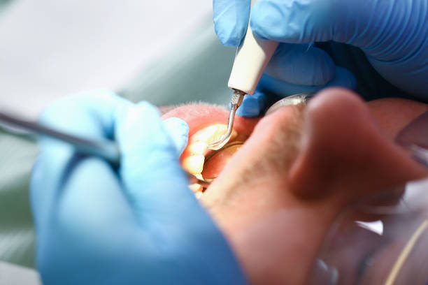 Best Emergency Dental Care for Broken or Chipped Teeth in Rainbow Park, FL